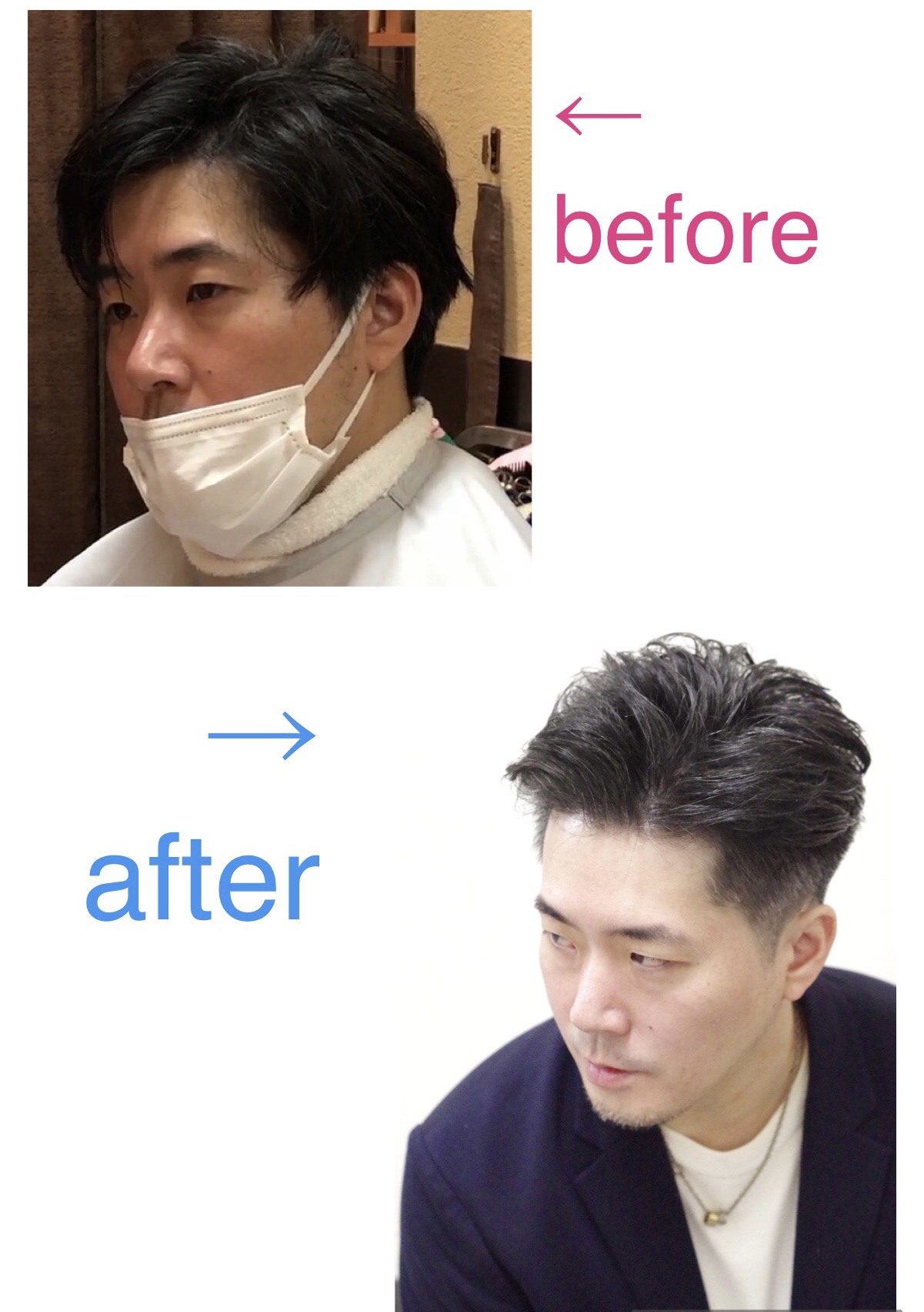 before after大人ツーブロックスタイル